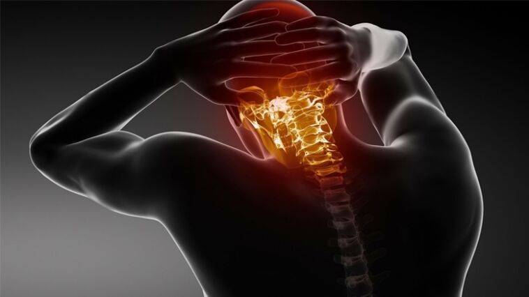 servikal osteokondroz ile başın arkasında ağrı