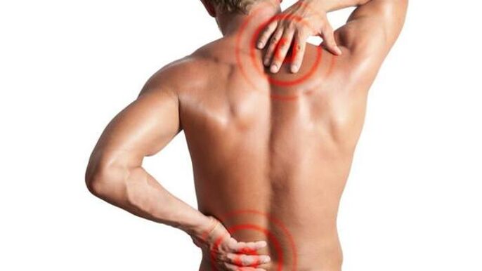 Osteokondroz nedeniyle ağrı