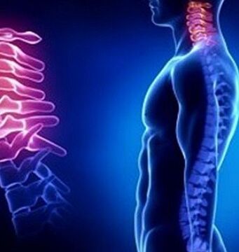 Boyun yaralanmaları servikal osteokondroza neden olabilir